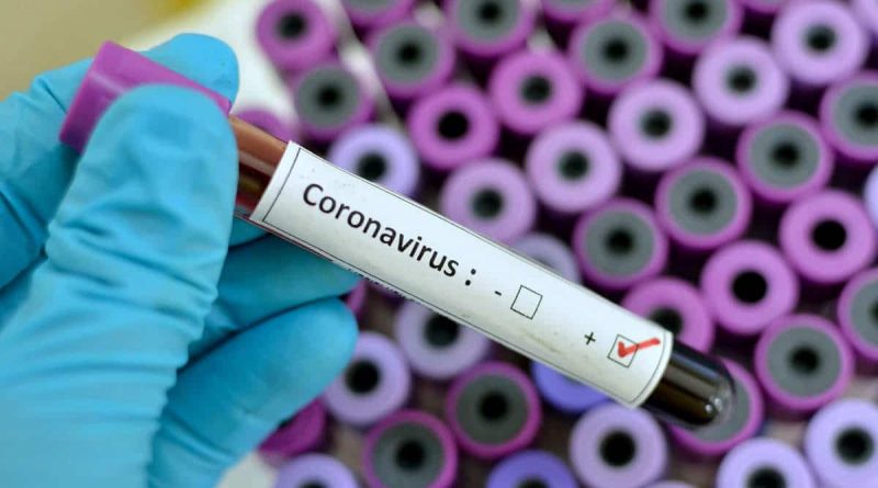 Coronavirus: Nigeria announces preventive measures, releases numbers