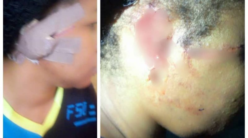 Unbelievable! Husband Bites Off His Wife's Ear In Niger State (Graphic Photos)