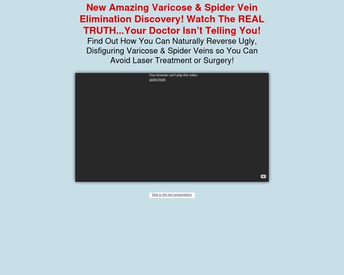 Varicose Veins Natural Treatment | Varicose Veins Home Treatment Program