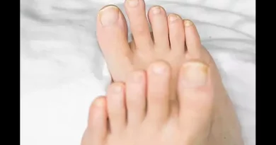 Best Over the Counter Toenail Fungus Treatment - Do They Really Work?